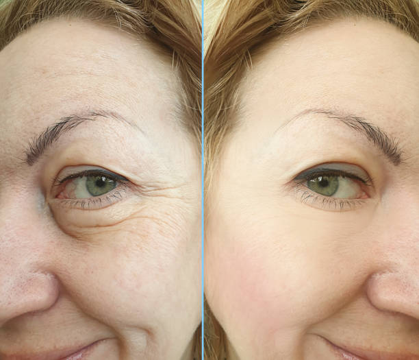 Sarah, 63 before and after