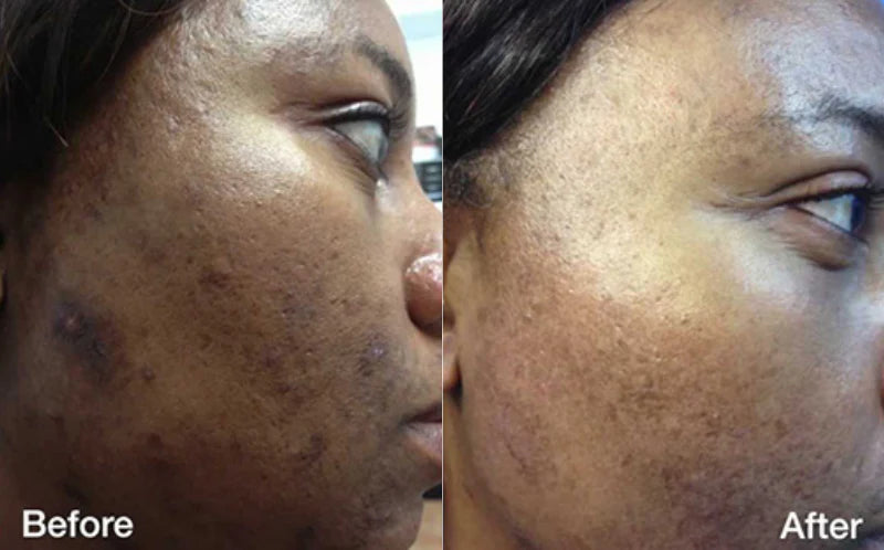 Tanya, 35 before and after