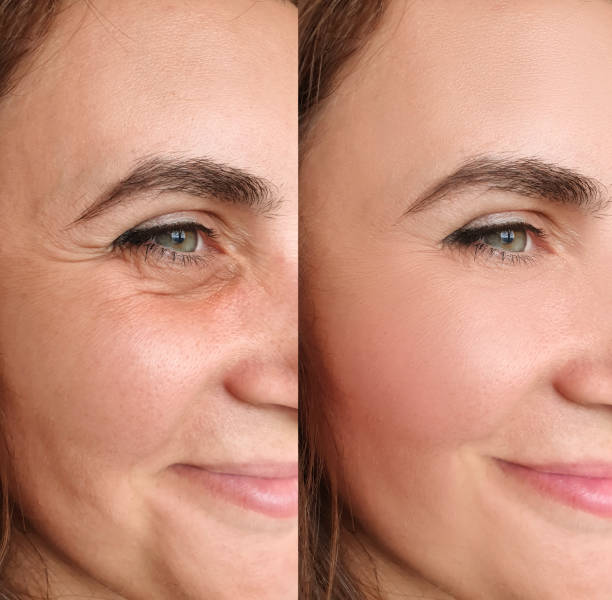 Jessica, 49 before and after